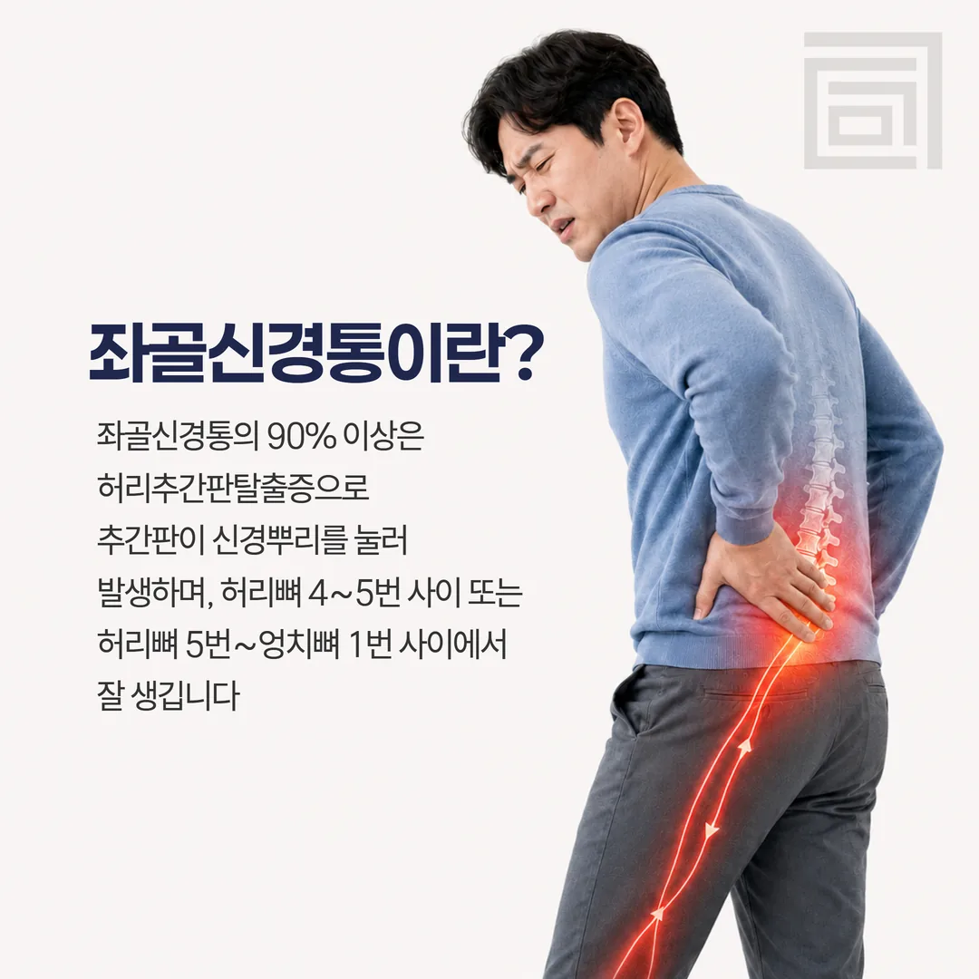 좌골신경 경로와 좌골신경통 통증 부위