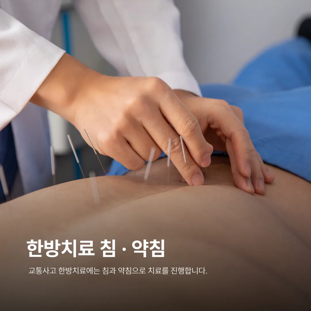 교통사고 한방치료 침 약침 시술 장면