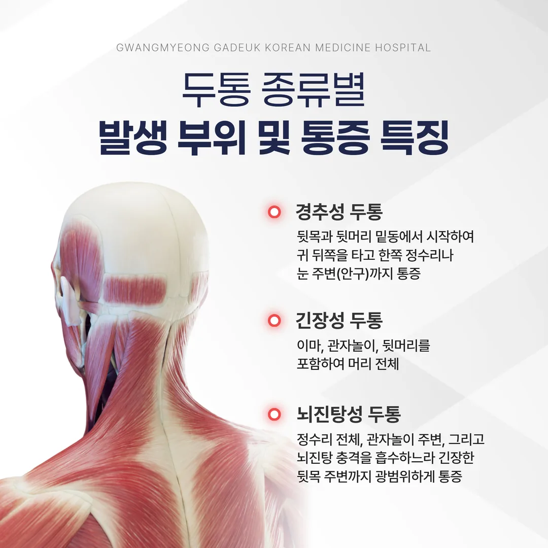 교통사고 두통 유형별 통증 부위 비교