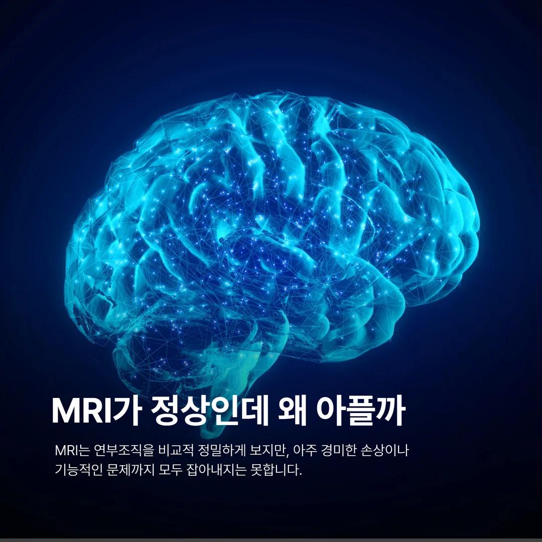 교통사고 MRI 정상 소견 설명