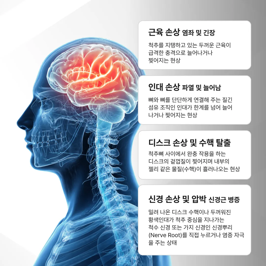 MRI에 잘 안 잡히는 연부조직 손상