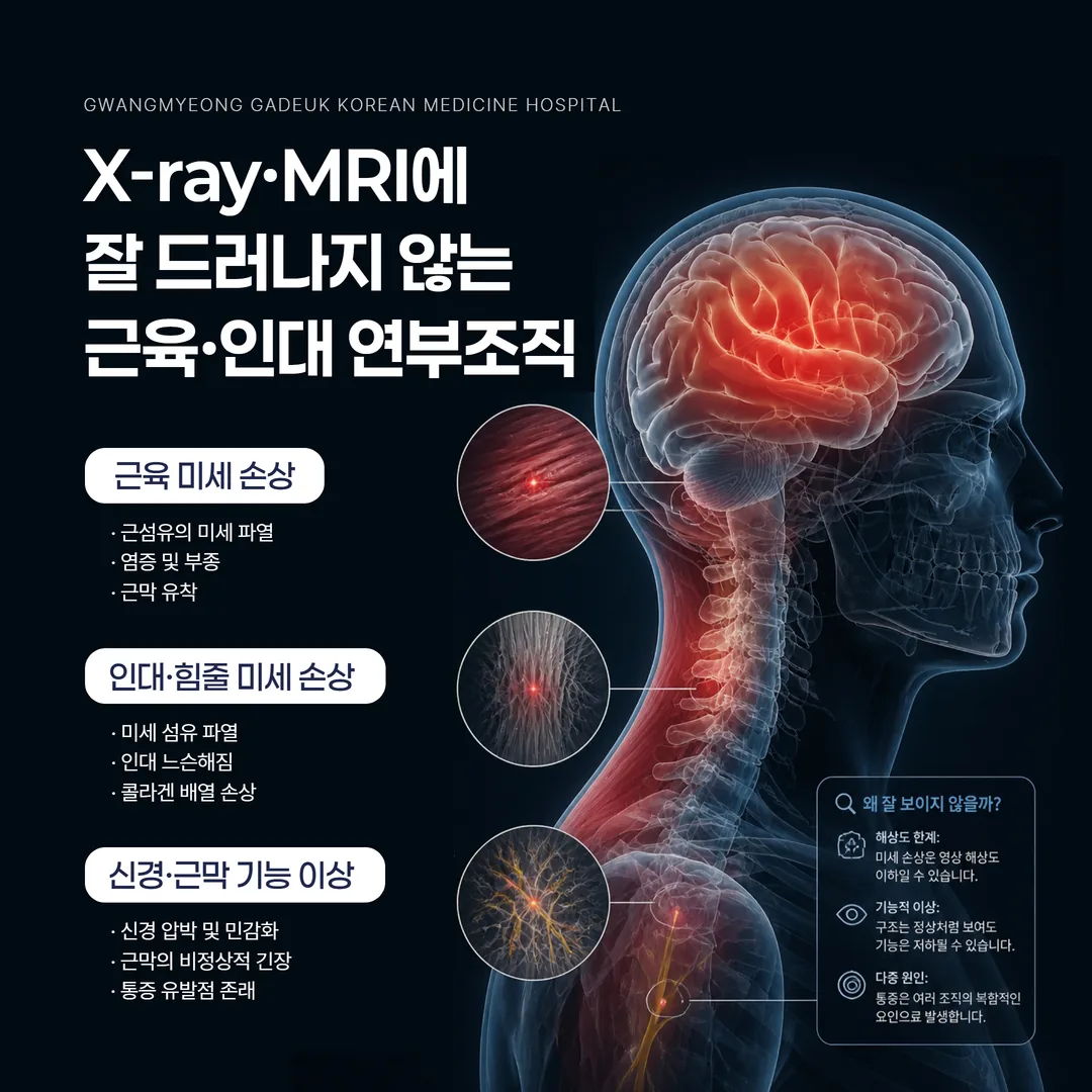 영상검사에 안 잡히는 연부조직 손상 개념도