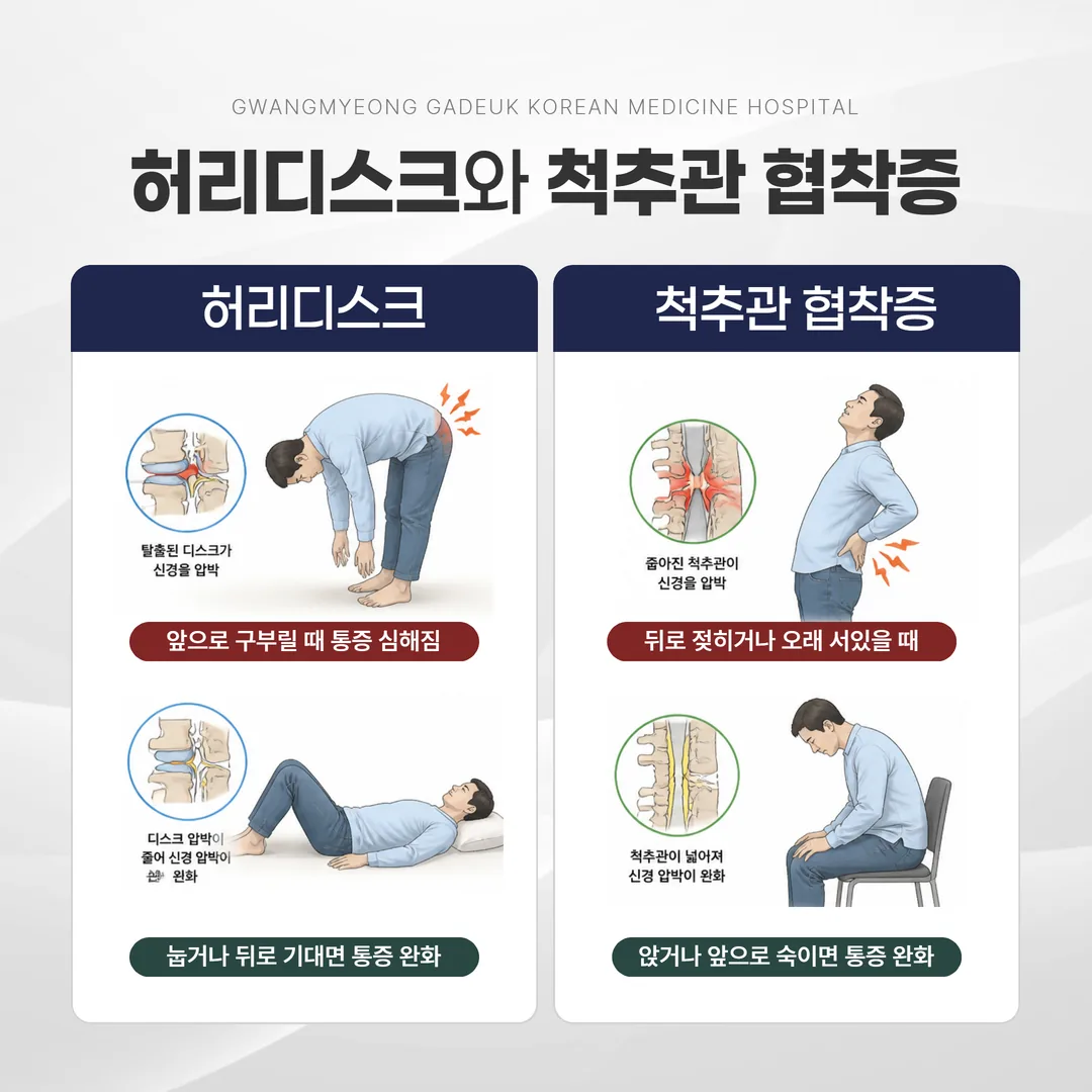 허리디스크와 척추관 협착증 자세별 통증 비교