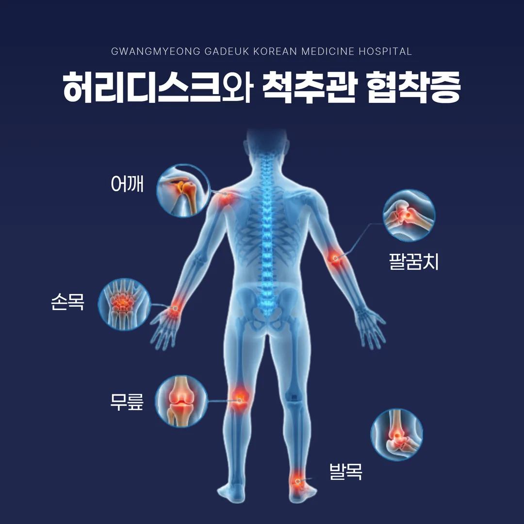부위별 관절 통증 질환 안내 그림