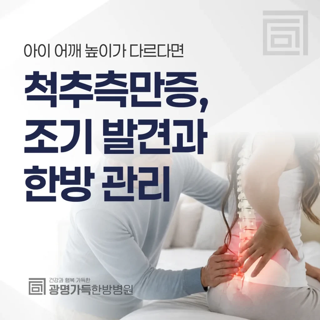 척추측만증, 조기 발견과 한방 관리 — 아이 어깨 높이가 다르다면