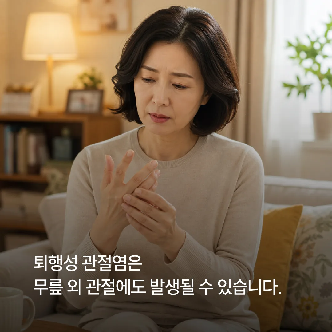 손가락 마디 통증을 살피는 중년 여성 — 퇴행성 관절염은 무릎 외 관절에도 발생