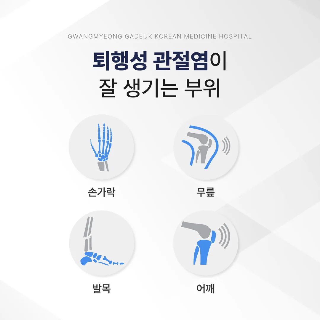 퇴행성 관절염이 잘 생기는 부위 — 손가락, 어깨, 무릎, 발목 인포그래픽