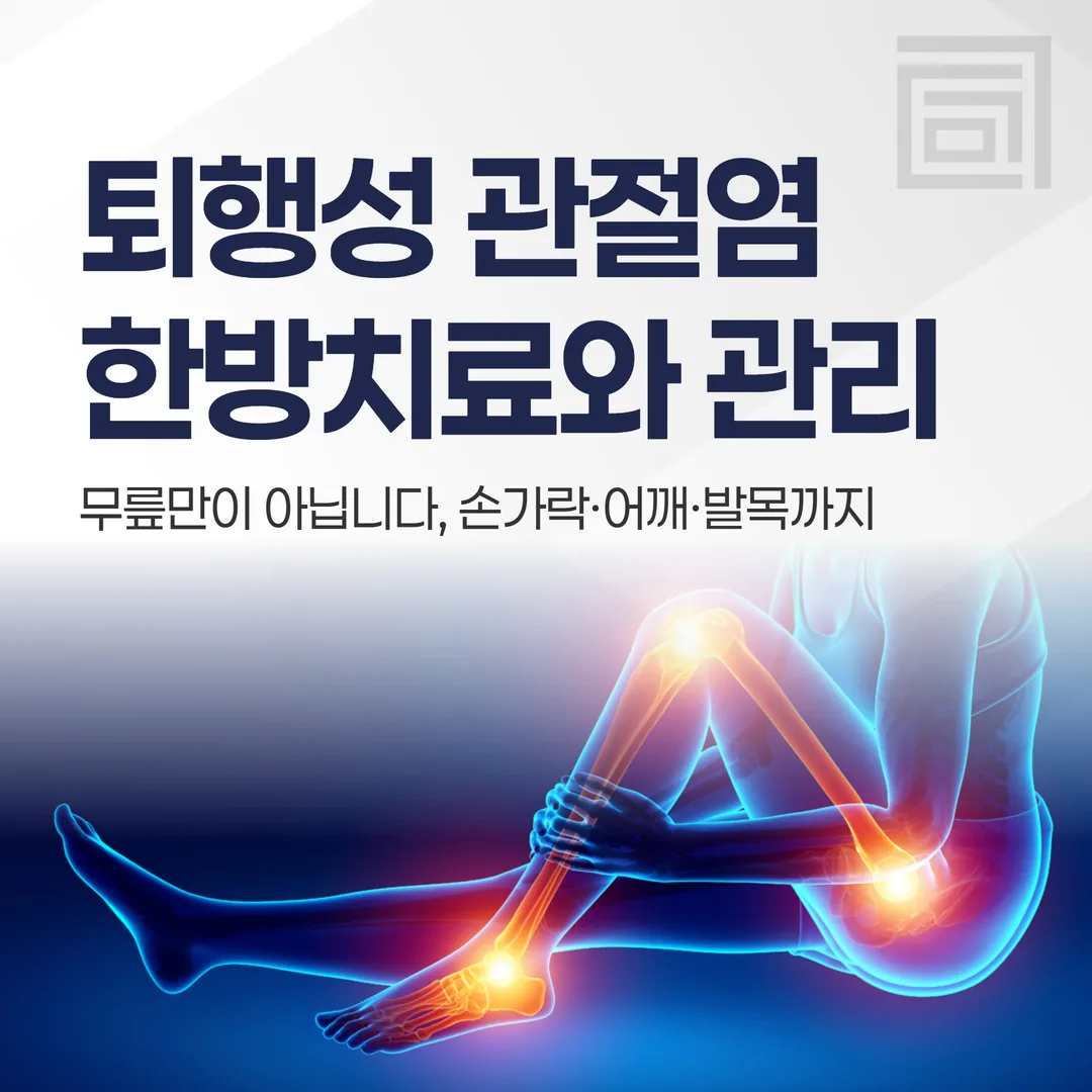 퇴행성 관절염 한방치료와 관리 — 무릎만이 아닙니다, 손가락·어깨·발목까지