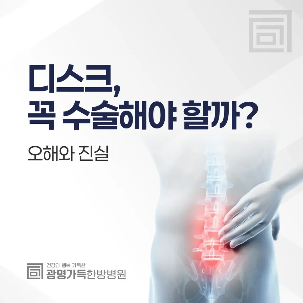 디스크, 꼭 수술해야 할까? 오해와 진실