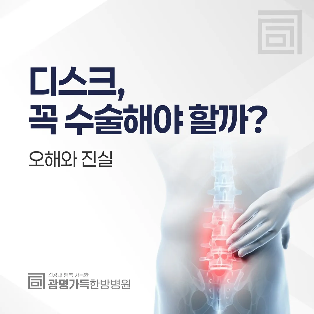 디스크, 꼭 수술해야 할까? 오해와 진실