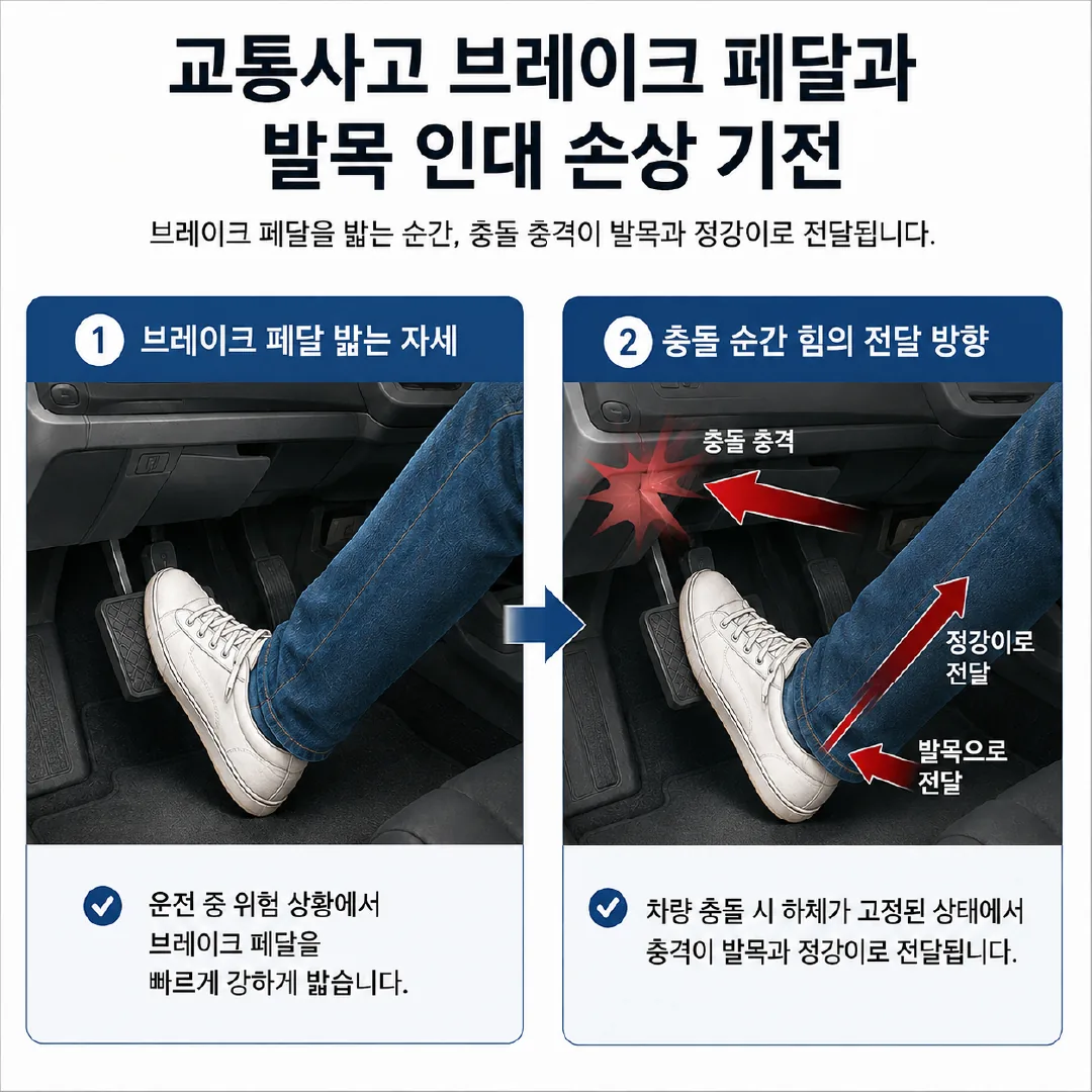 교통사고 브레이크 페달 발목 인대 손상 기전 도해