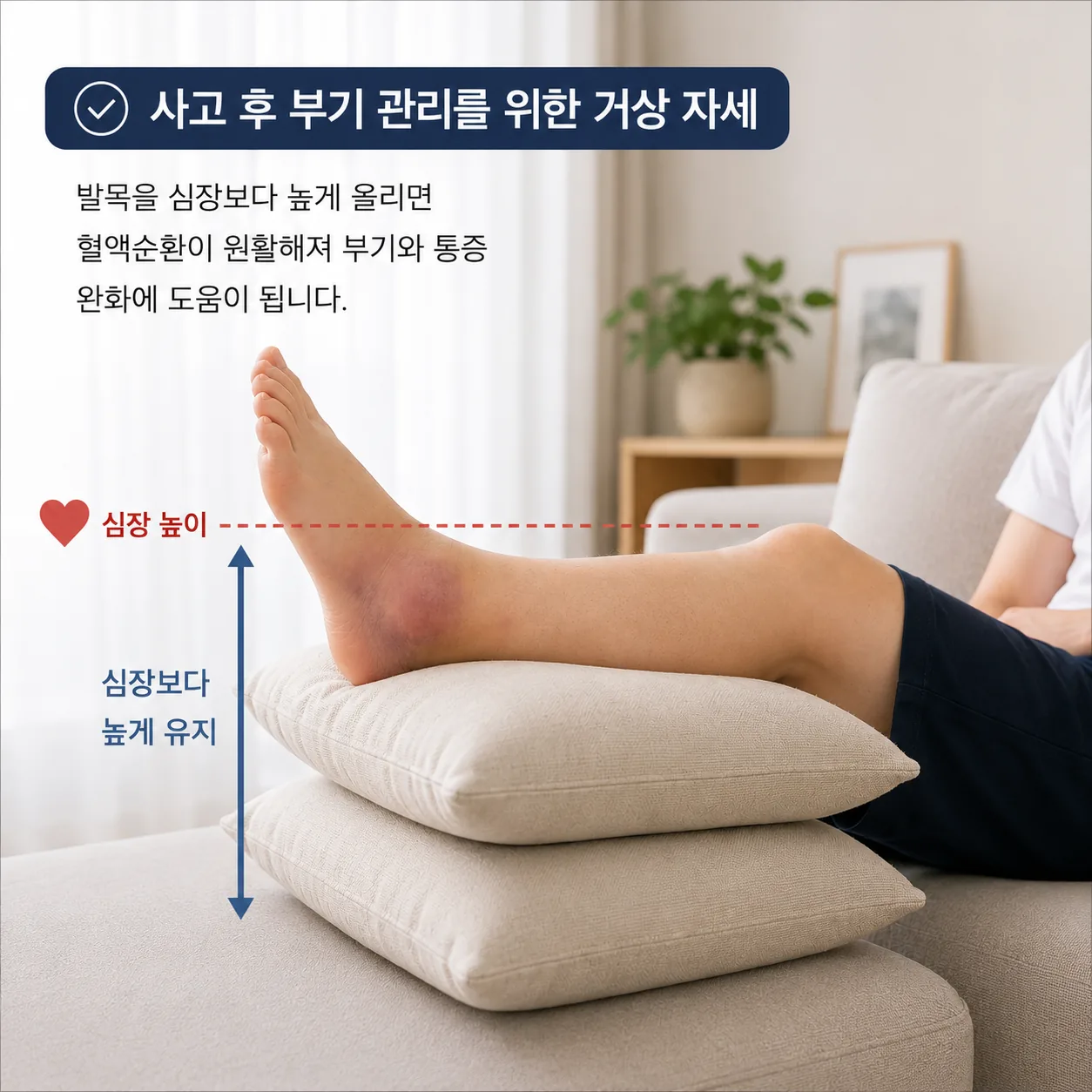 사고 후 부기 관리를 위해 발목을 심장보다 높게 올린 거상 자세