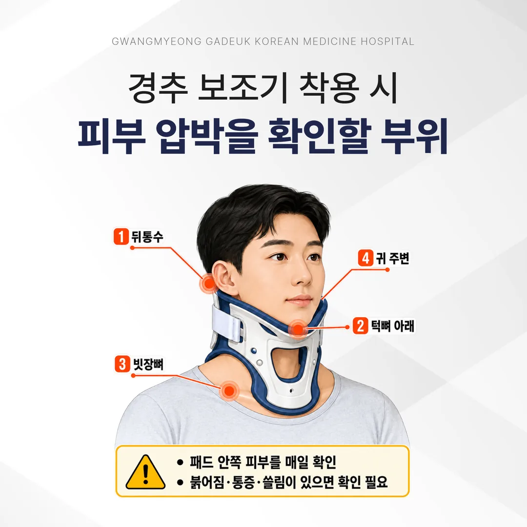 경추 보조기 착용 시 피부 압박을 확인할 부위
