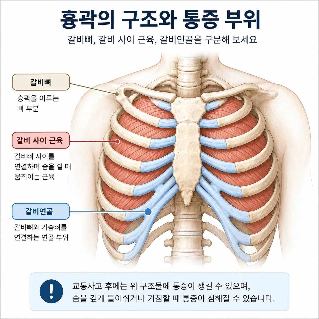갈비뼈와 갈비 사이 근육, 가슴 앞쪽 연골 부위를 구분해 표시한 흉곽 그림