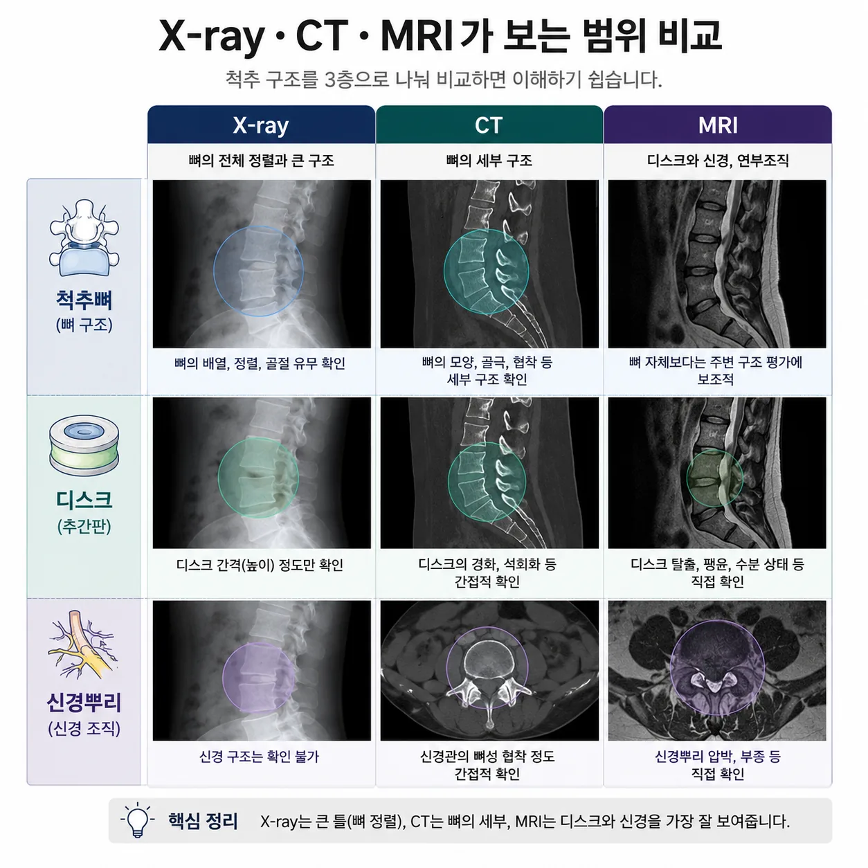 X-ray CT MRI가 보는 범위 비교 그림