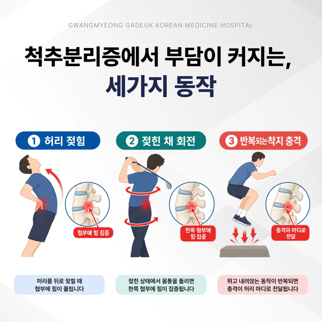 척추분리증에서 부담이 커지는 젖힘 회전 충격 세 가지 동작 조건 비교