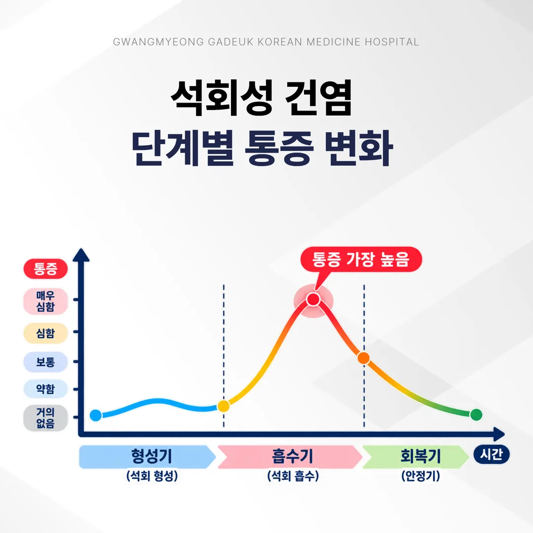 석회성 건염 단계별 통증 변화 곡선 그래프