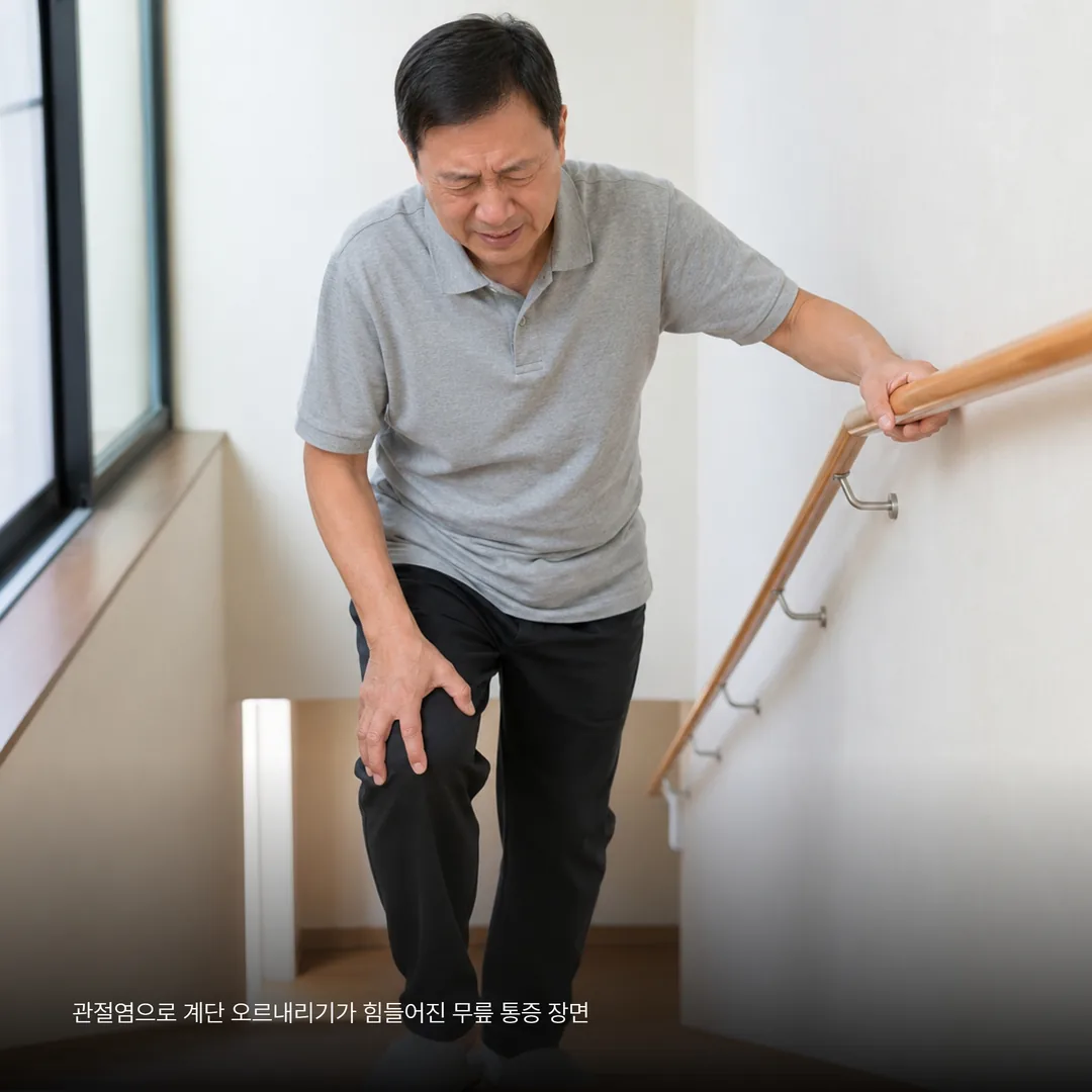 관절염으로 계단 오르내리기가 힘들어진 무릎 통증 장면