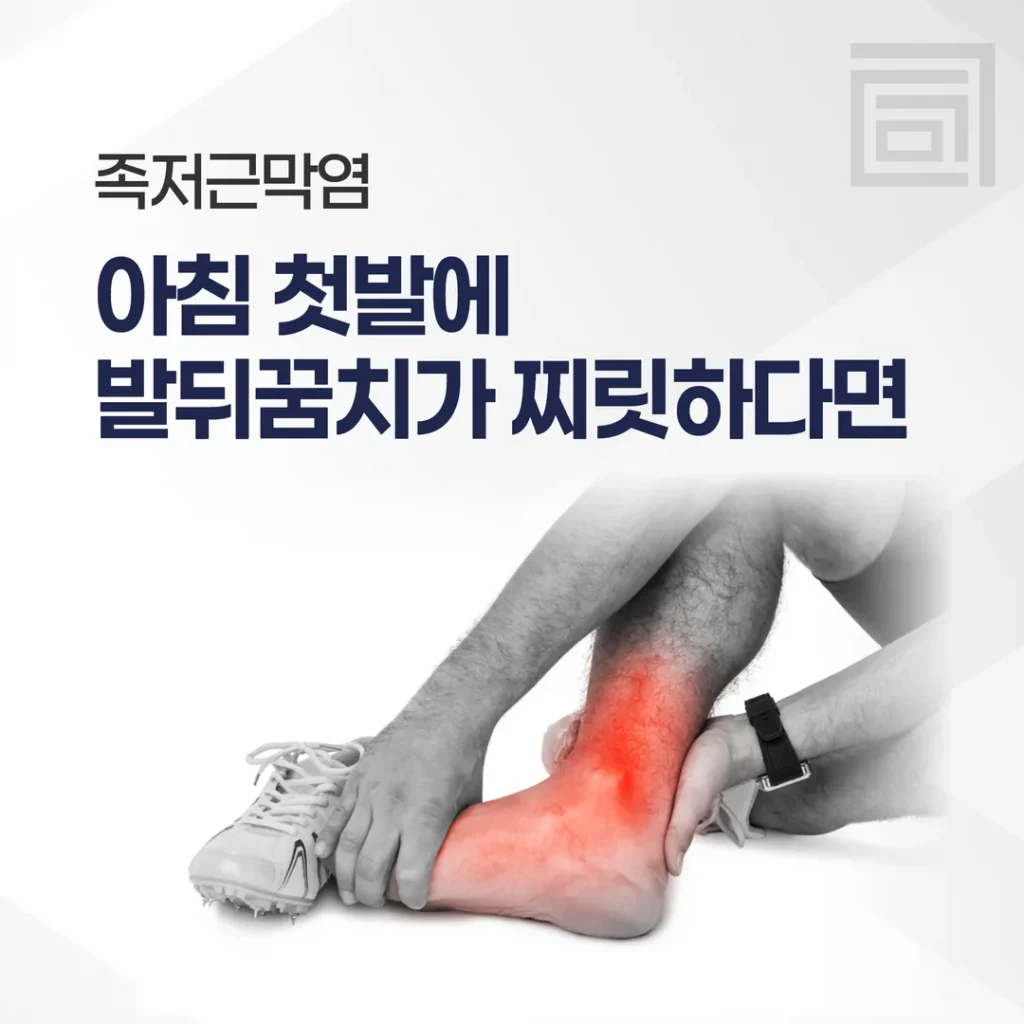 아침 첫발에 발뒤꿈치가 찌릿하다면 — 족저근막염일까
