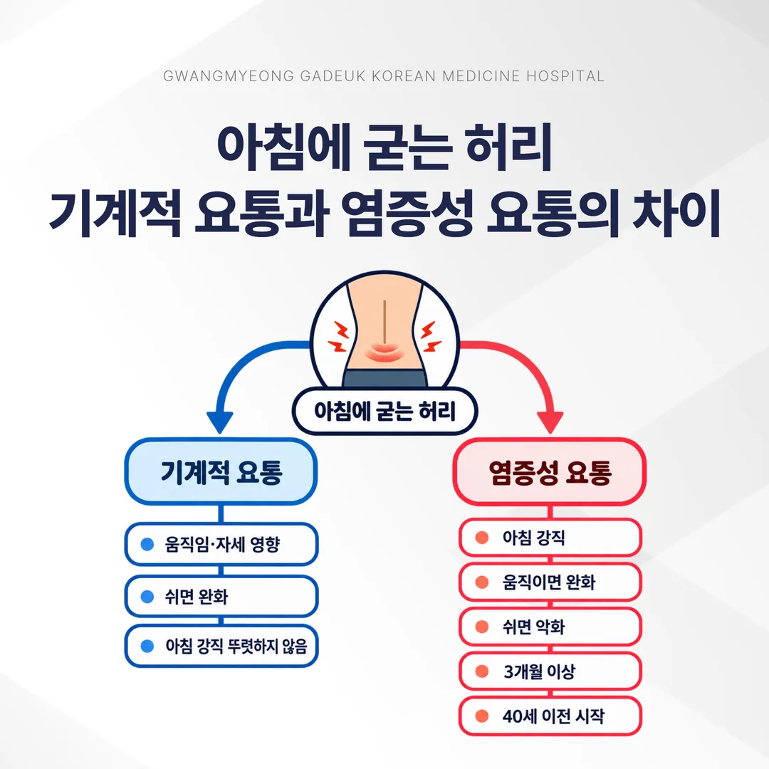 아침 허리 뻣뻣함이 기계적 요통과 염증성 요통으로 갈리는 개념도