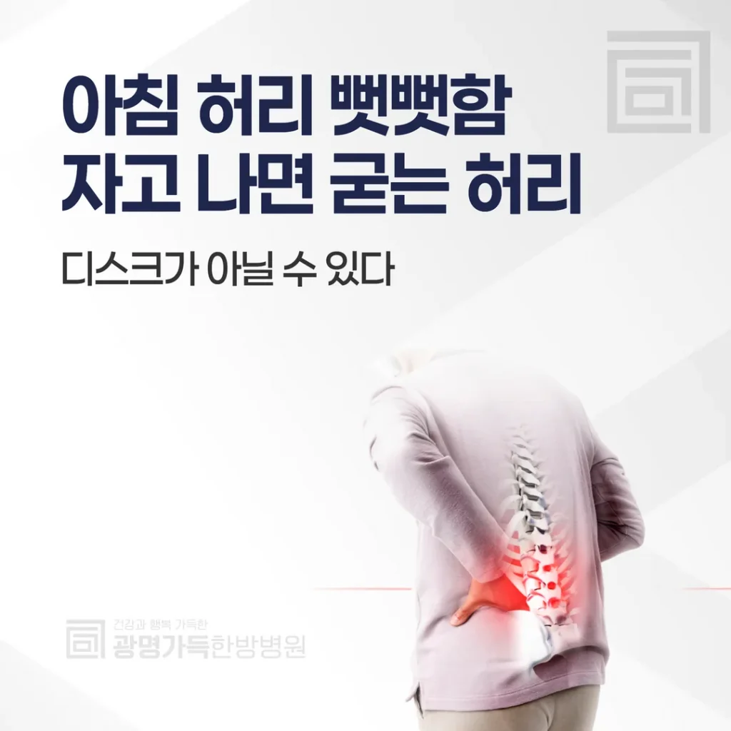 아침 허리 뻣뻣함, 자고 나면 굳는 허리 — 디스크가 아닐 수 있다