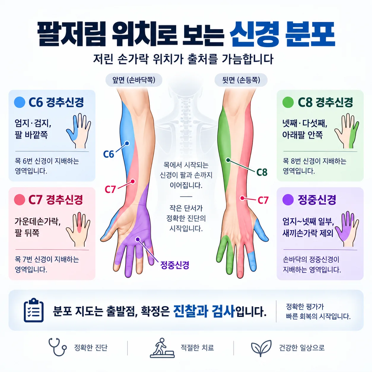 경추 신경 마디별 팔과 손가락 저림 분포 지도