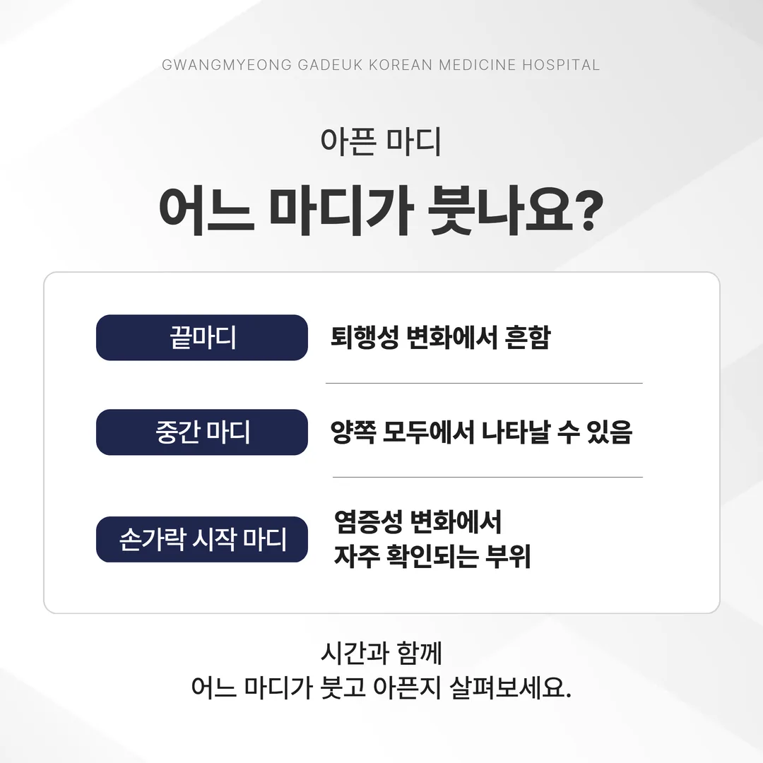 손가락 끝마디 중간 마디 손허리손가락관절의 위치를 표시한 손 개념도